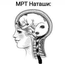 МРТ Наташи )