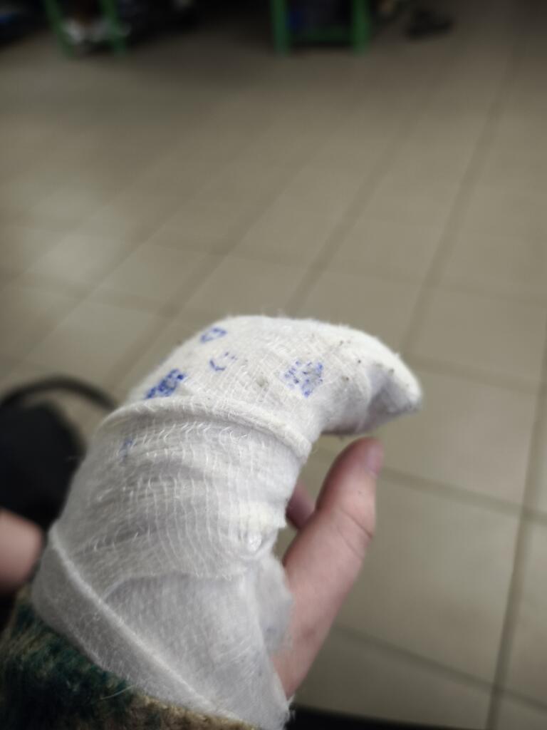 Вот фото гипса (одноклассницы его разрисовали :P )
